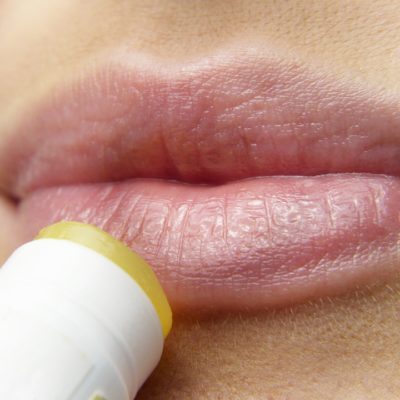 How To Get Rid Of That Cold Sore Before The Big Day